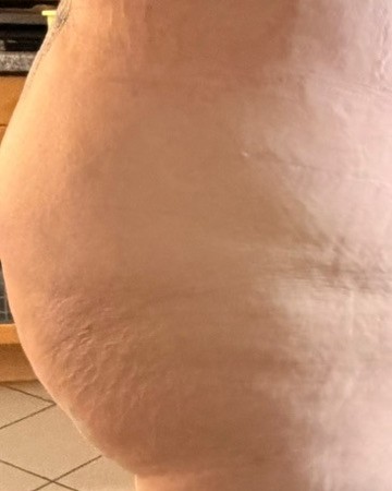 Testerin 3 nach vier Wochen